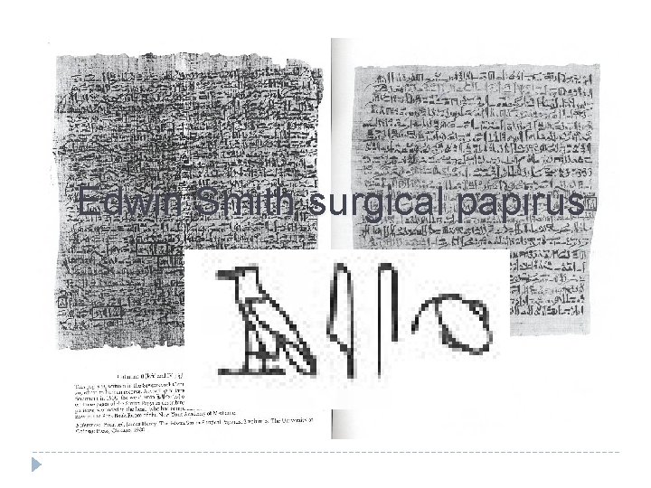 Edwin Smith surgical papirus 
