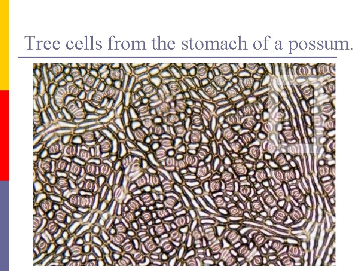 Tree cells from the stomach of a possum. 