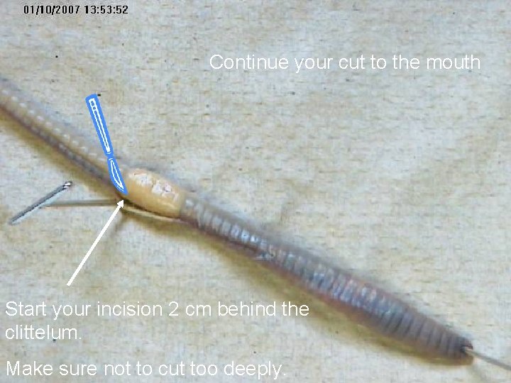 Continue your cut to the mouth Start your incision 2 cm behind the clittelum.