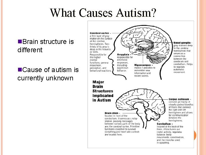What Causes Autism? n. Brain structure is different n. Cause of autism is currently
