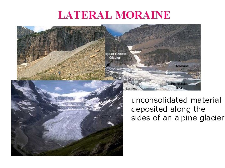 LATERAL MORAINE unconsolidated material deposited along the sides of an alpine glacier.  LATERAL MORAINE unconsolidated material deposited along the sides of an alpine glacier.