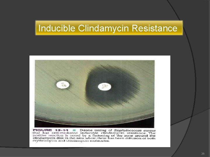 Inducible Clindamycin Resistance 39 