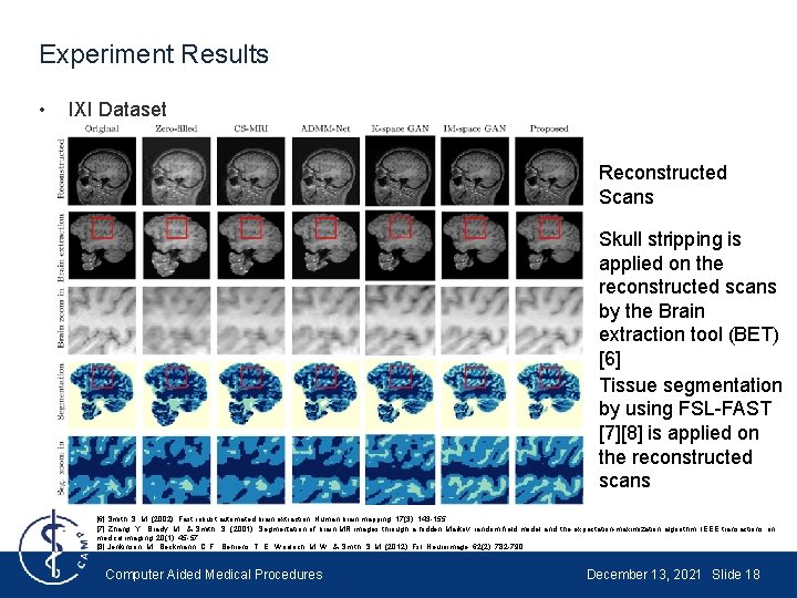 Experiment Results • IXI Dataset Reconstructed Scans Skull stripping is applied on the reconstructed Experiment Results • IXI Dataset Reconstructed Scans Skull stripping is applied on the reconstructed