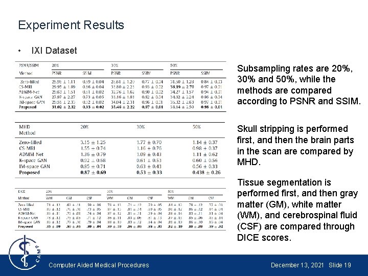 Experiment Results • IXI Dataset Subsampling rates are 20%, 30% and 50%, while the Experiment Results • IXI Dataset Subsampling rates are 20%, 30% and 50%, while the