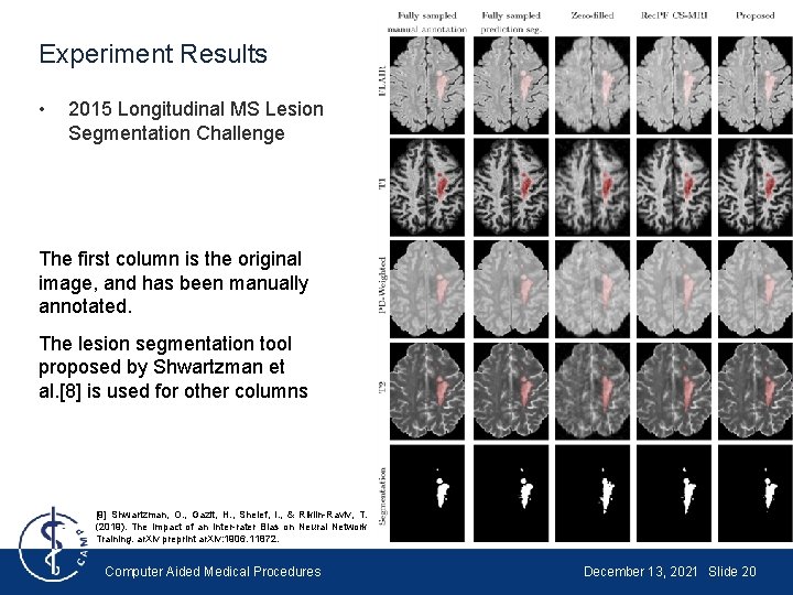 Experiment Results • 2015 Longitudinal MS Lesion Segmentation Challenge The first column is the Experiment Results • 2015 Longitudinal MS Lesion Segmentation Challenge The first column is the