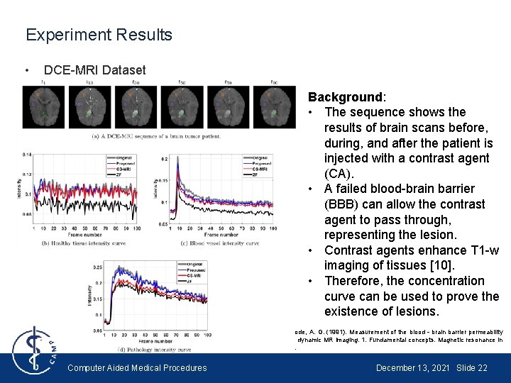 Experiment Results • DCE-MRI Dataset Background: • The sequence shows the results of brain Experiment Results • DCE-MRI Dataset Background: • The sequence shows the results of brain