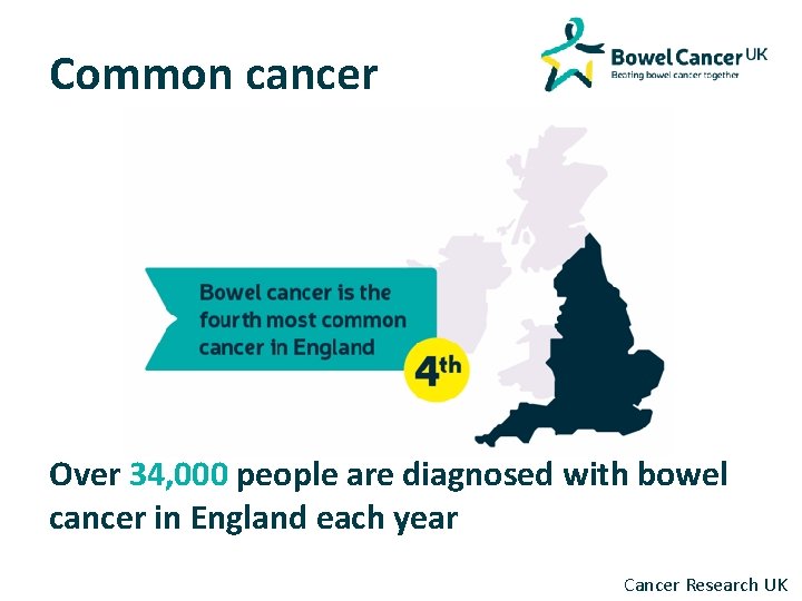 Common cancer Over 34, 000 people are diagnosed with bowel cancer in England each