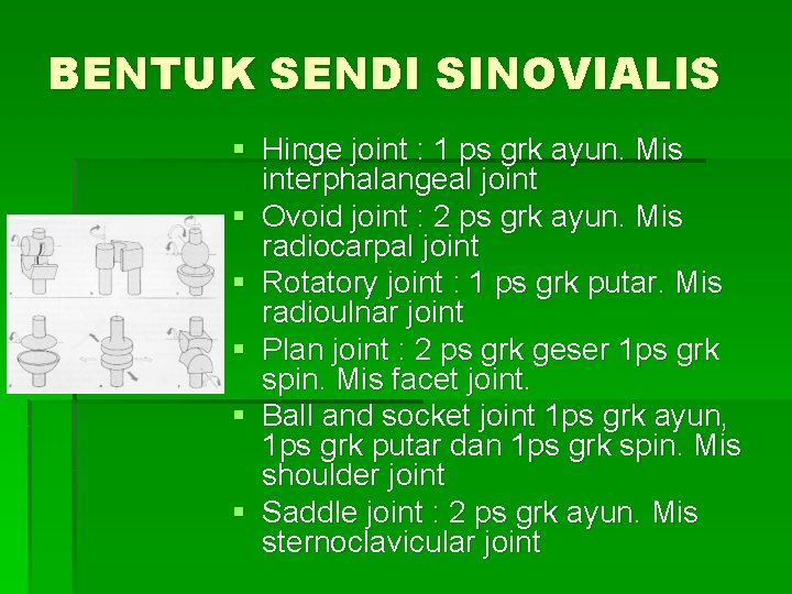 BENTUK SENDI SINOVIALIS § Hinge joint : 1 ps grk ayun. Mis interphalangeal joint
