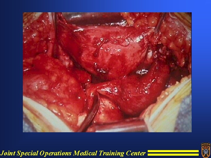 Joint Special Operations Medical Training Center 