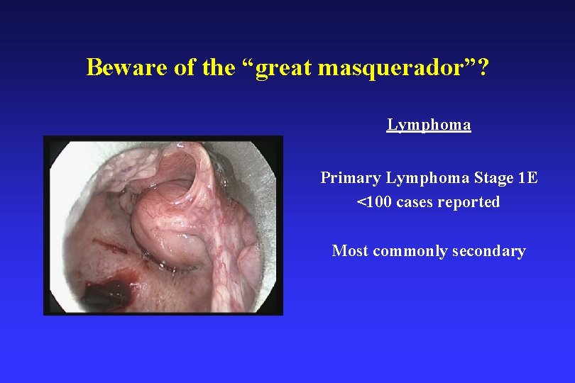 Beware of the “great masquerador”? Lymphoma Primary Lymphoma Stage 1 E <100 cases reported