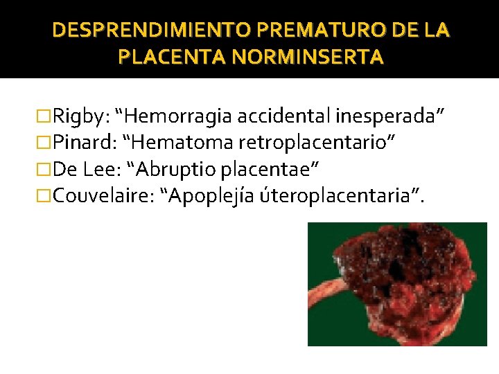 DESPRENDIMIENTO PREMATURO DE LA PLACENTA NORMINSERTA �Rigby: “Hemorragia accidental inesperada” �Pinard: “Hematoma retroplacentario” �De