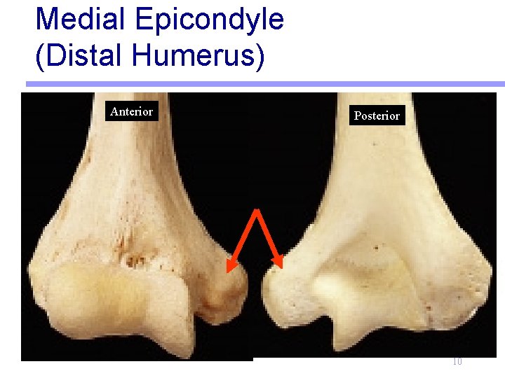 Medial Epicondyle (Distal Humerus) Anterior Posterior 10 