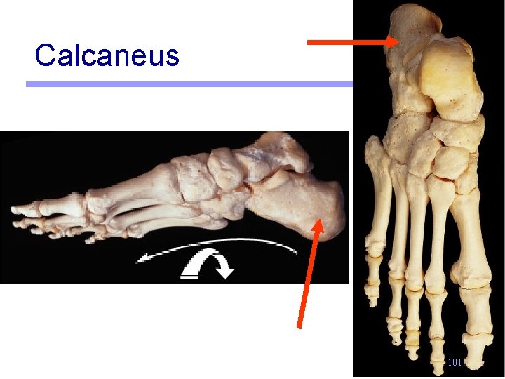 Calcaneus 101 