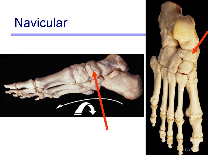 Navicular 102 