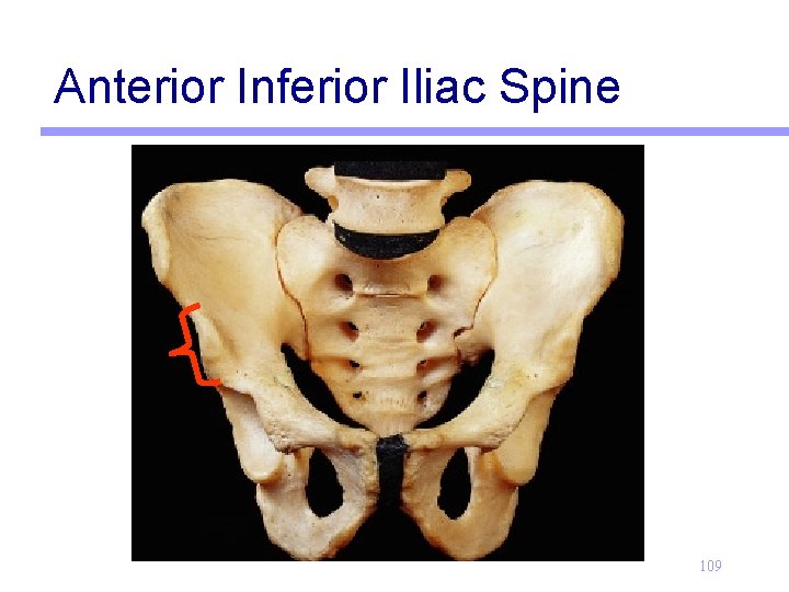Anterior Inferior Iliac Spine 109 