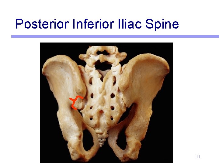 Posterior Inferior Iliac Spine 111 