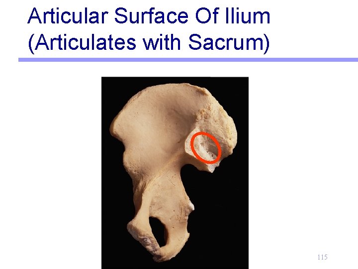 Articular Surface Of Ilium (Articulates with Sacrum) 115 