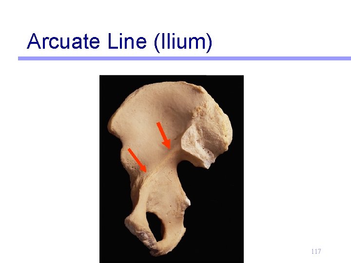 Arcuate Line (Ilium) 117 