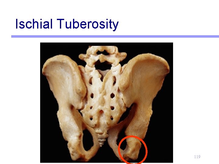 Ischial Tuberosity 119 