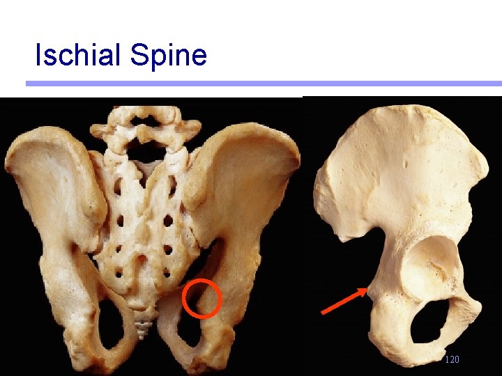 Ischial Spine 120 