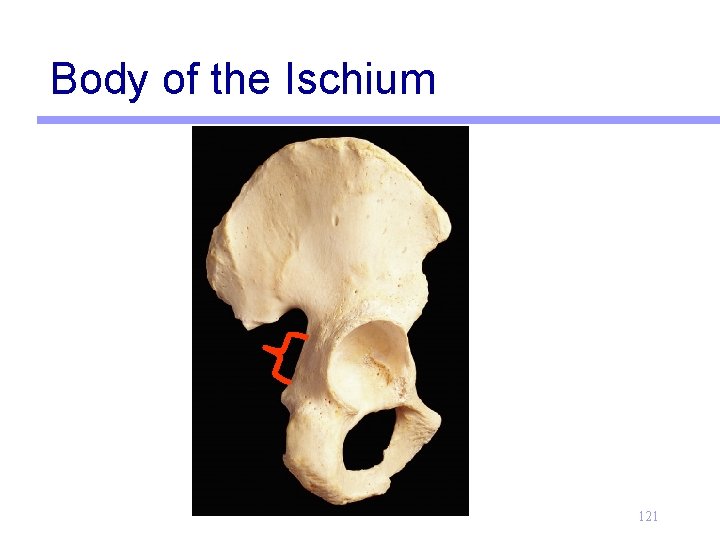 Body of the Ischium 121 