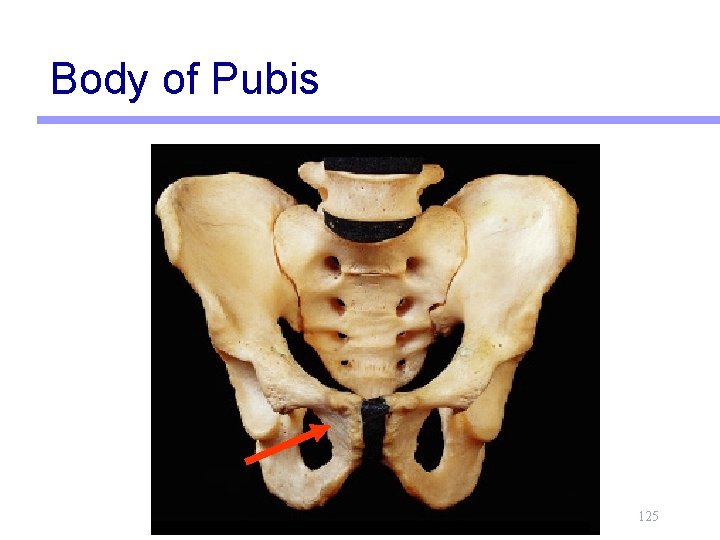 Body of Pubis 125 