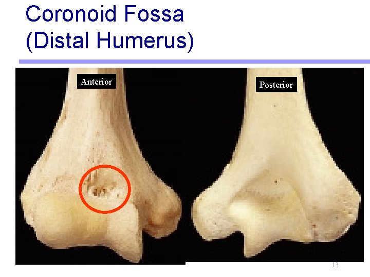 Coronoid Fossa (Distal Humerus) Anterior Posterior 13 