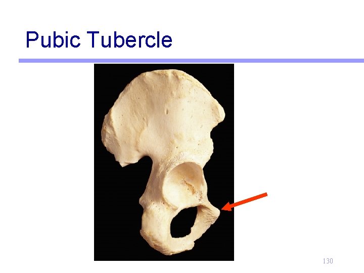 Pubic Tubercle 130 
