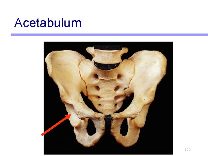 Acetabulum 133 