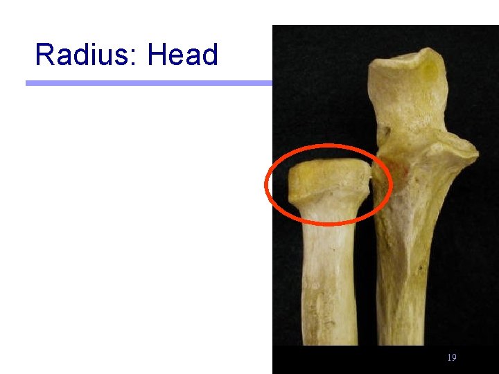 Radius: Head 19 