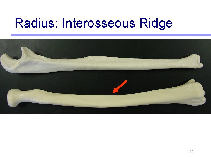 Radius: Interosseous Ridge 23 