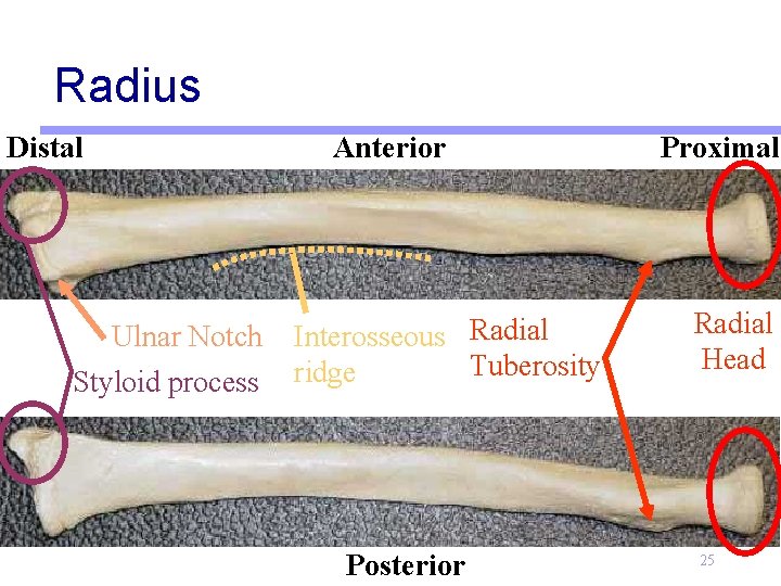 Radius Distal Ulnar Notch Styloid process Anterior Interosseous Radial Tuberosity ridge Posterior Proximal Radial