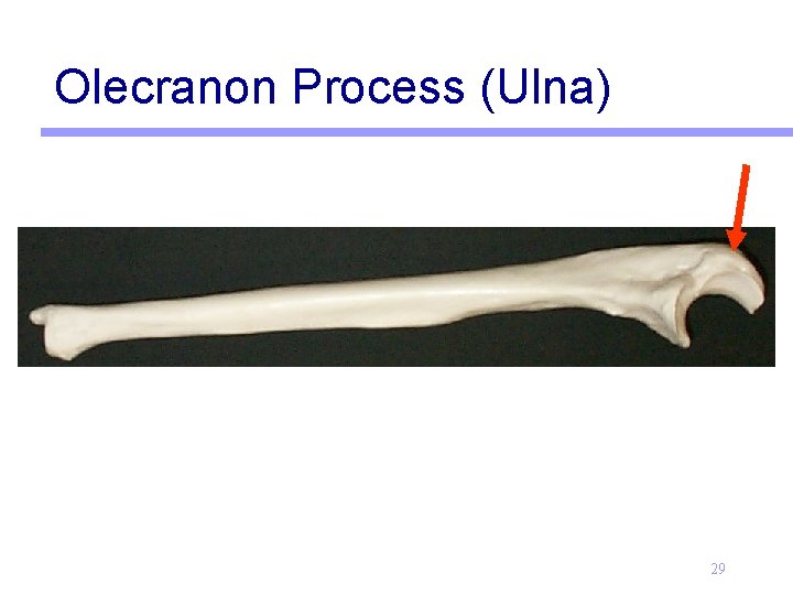 Olecranon Process (Ulna) 29 