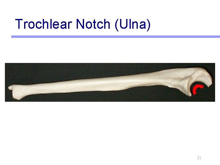Trochlear Notch (Ulna) 31 