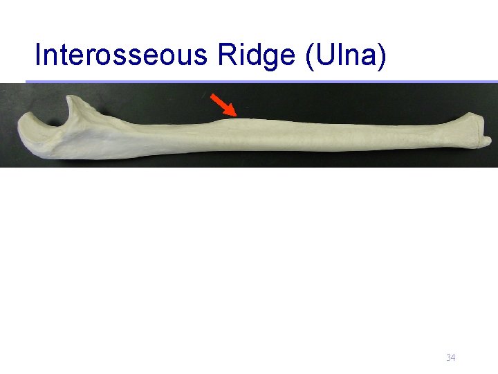 Interosseous Ridge (Ulna) 34 