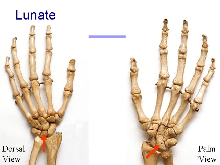 Lunate Dorsal View Palm 37 View 