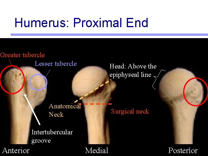 Humerus: Proximal End Greater tubercle Lesser tubercle Head: Above the epiphyseal line Anatomical Neck