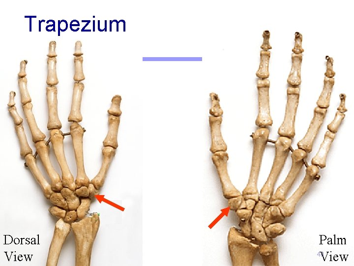 Trapezium Dorsal View Palm 40 View 