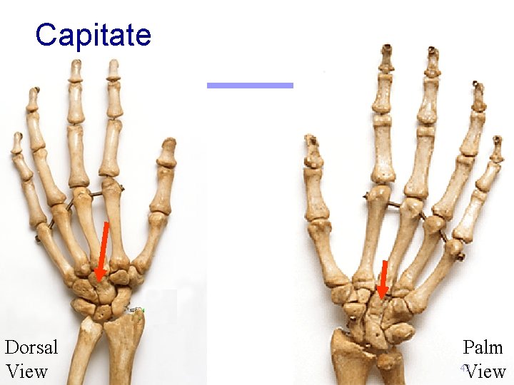 Capitate Dorsal View Palm 42 View 