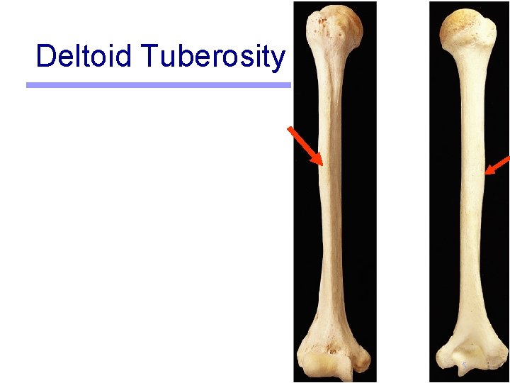 Deltoid Tuberosity 5 