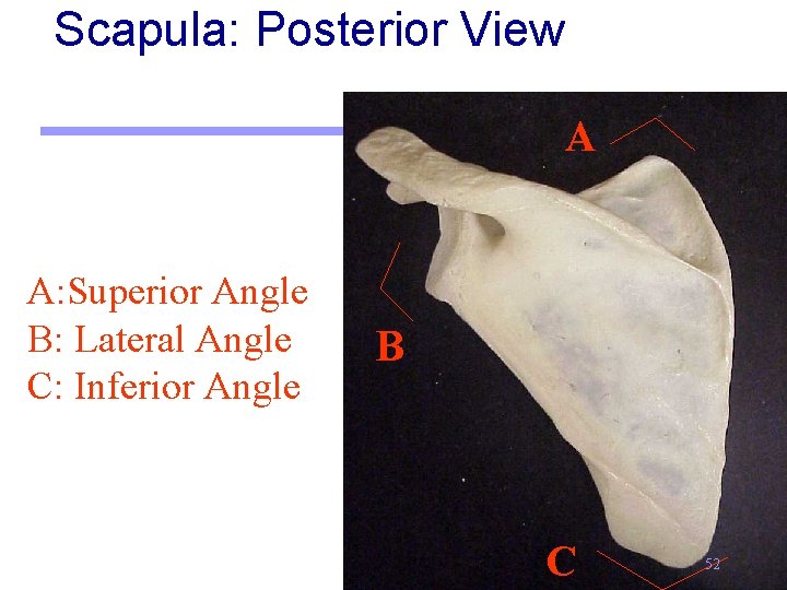 Scapula: Posterior View A A: Superior Angle B: Lateral Angle C: Inferior Angle B