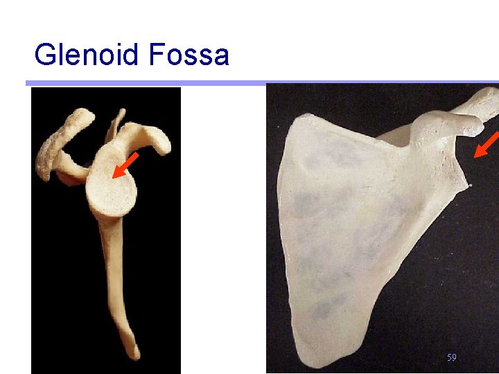 Glenoid Fossa 59 