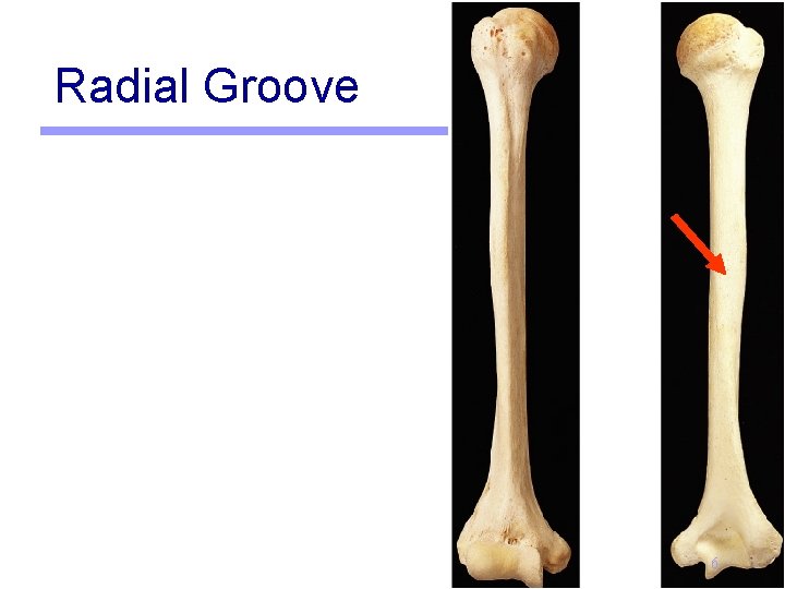 Radial Groove 6 