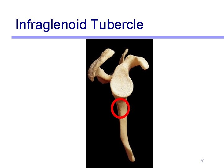 Infraglenoid Tubercle 61 