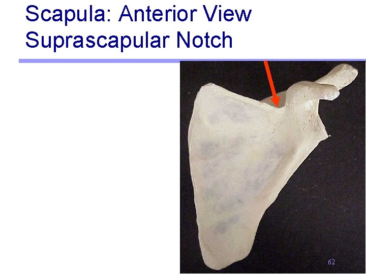 Scapula: Anterior View Suprascapular Notch 62 