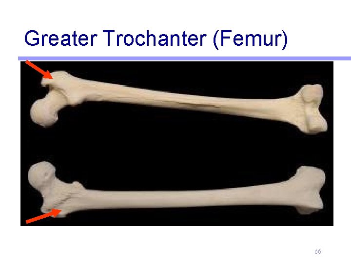 Greater Trochanter (Femur) 66 