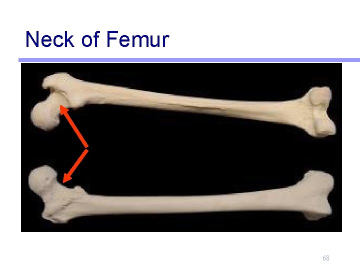 Neck of Femur 68 