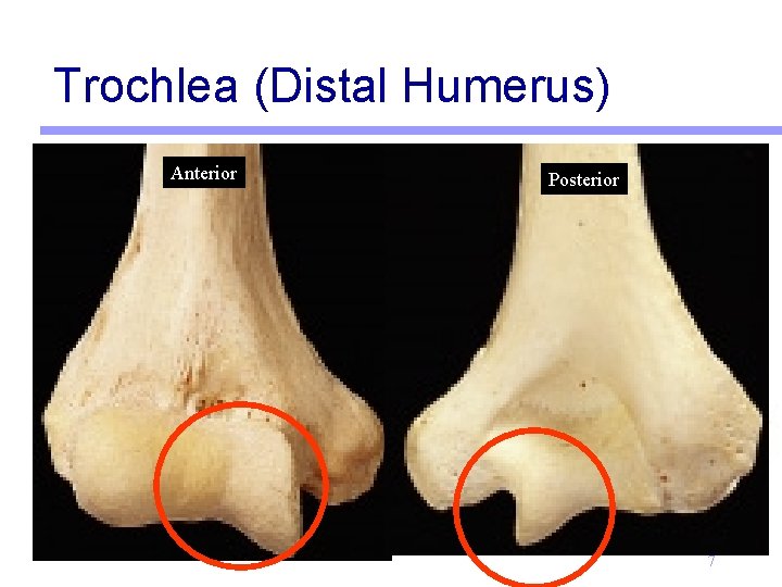 Trochlea (Distal Humerus) Anterior Posterior 7 