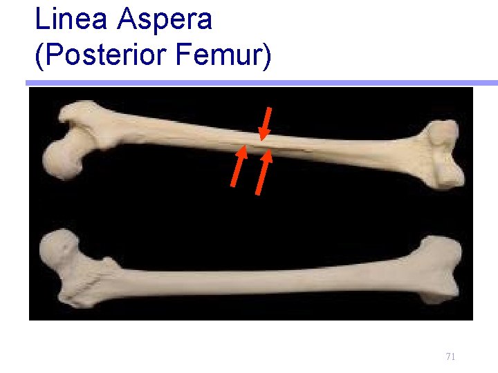 Linea Aspera (Posterior Femur) 71 