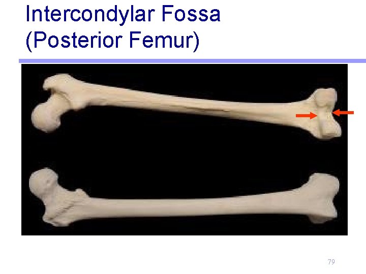 Intercondylar Fossa (Posterior Femur) 79 